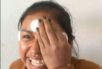 Estrabismo y Ojo Derecho No Ve